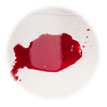 Environmental Cleaning Services in London - Blood Spill Cleanup